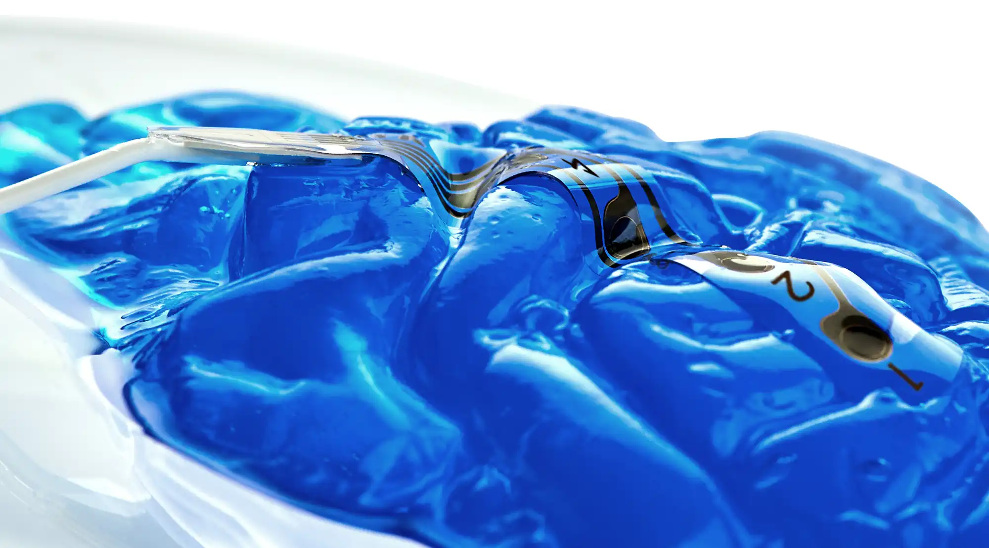 WISE Cortical Strip (WCS®)